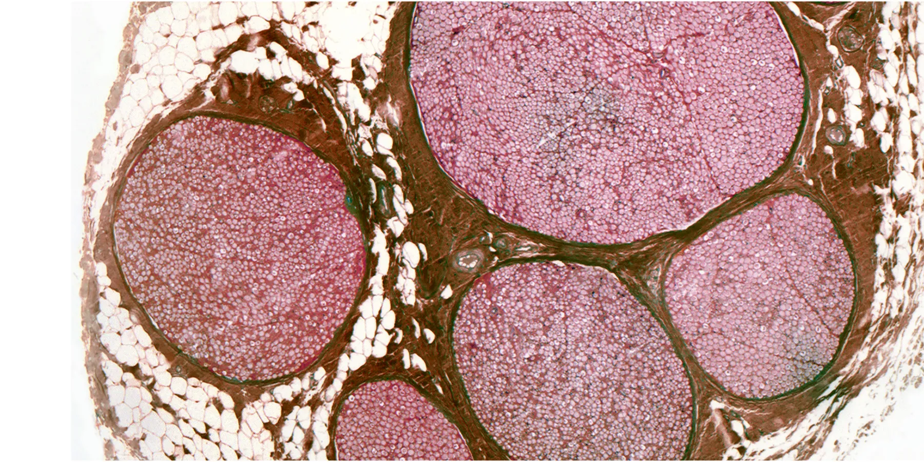 pathology