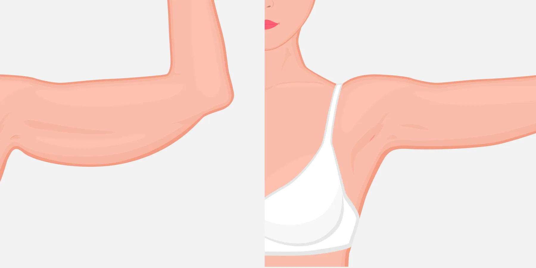 plastic surgery