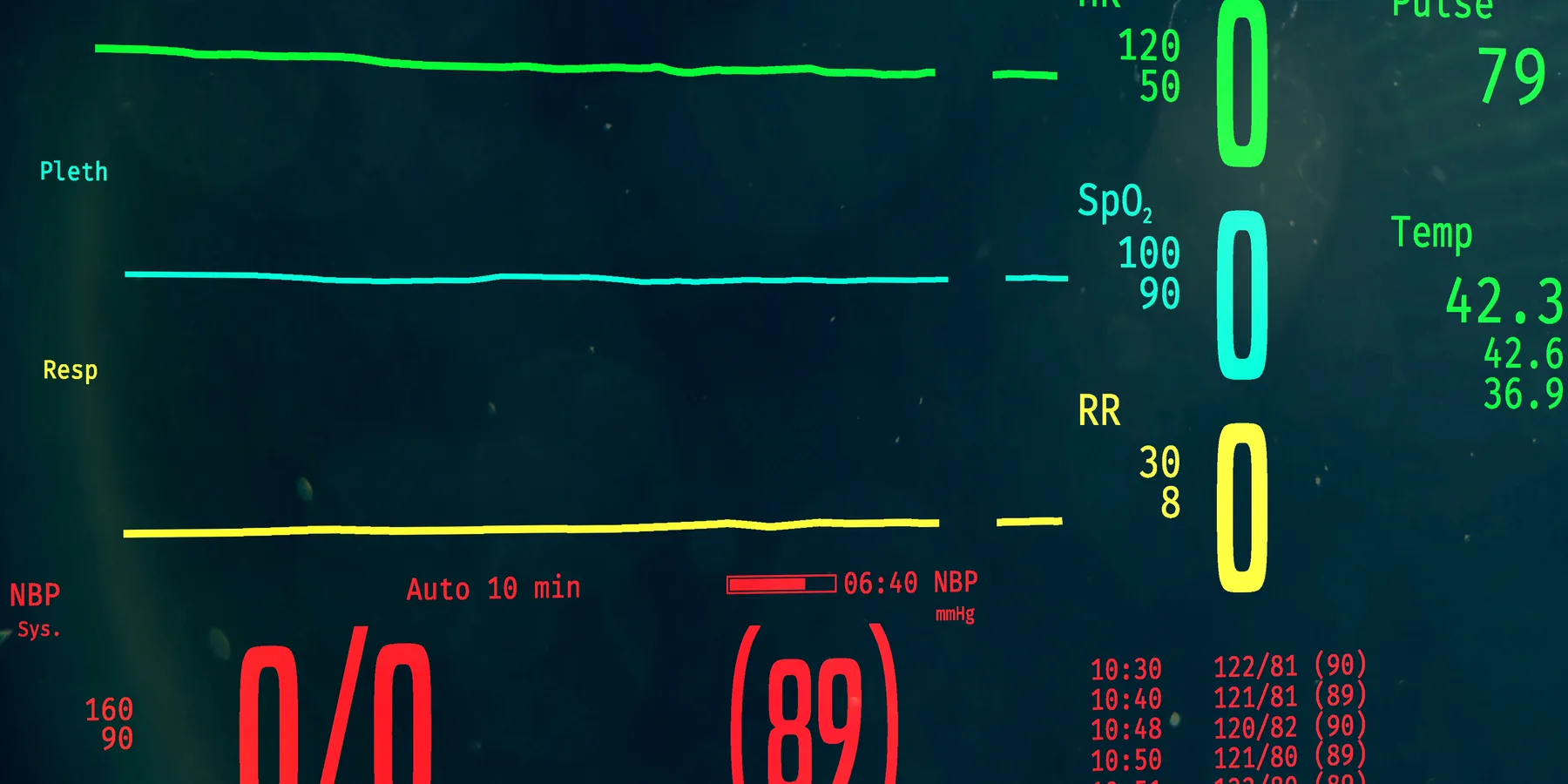 ICU