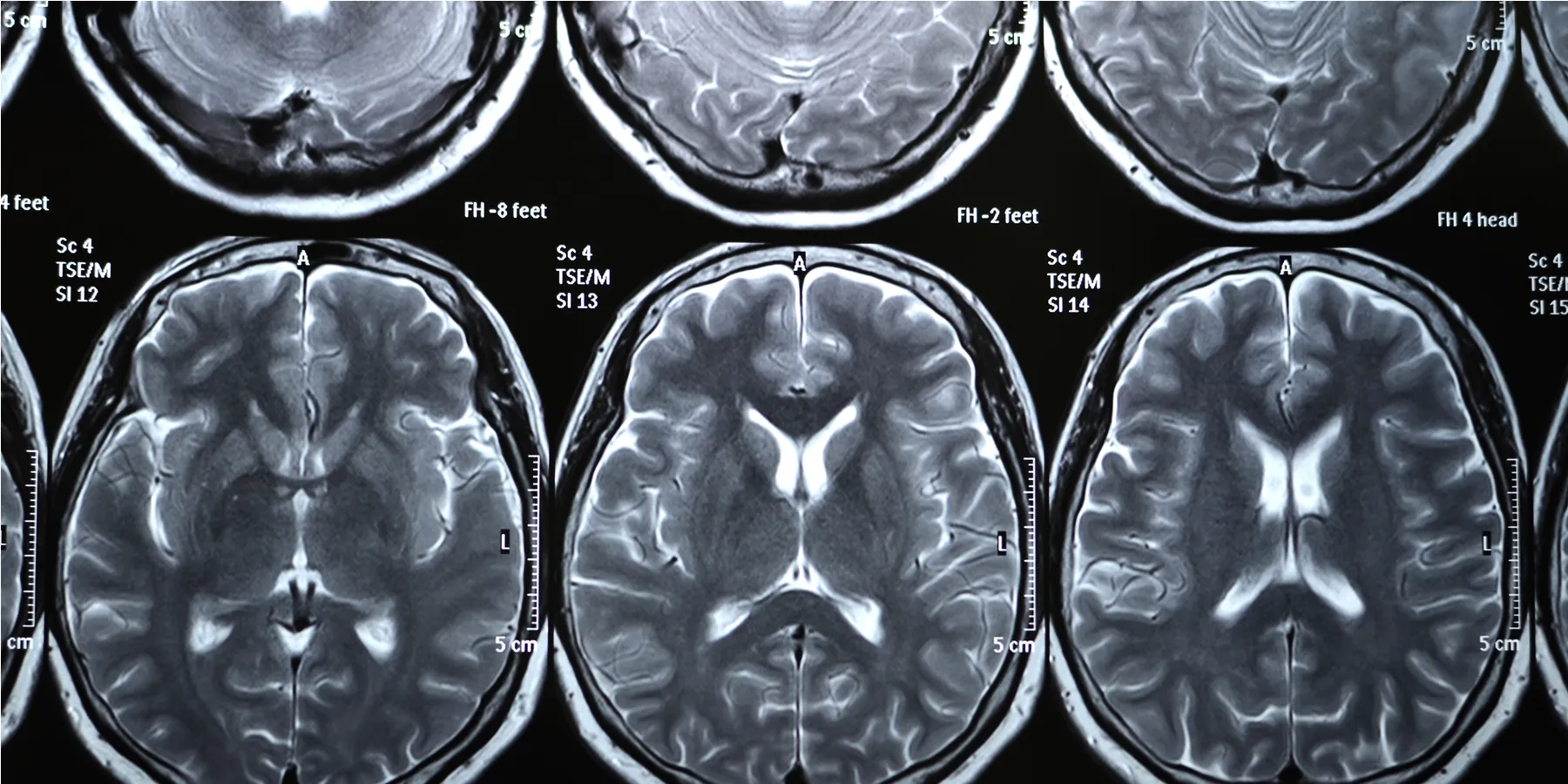 neuroimaging