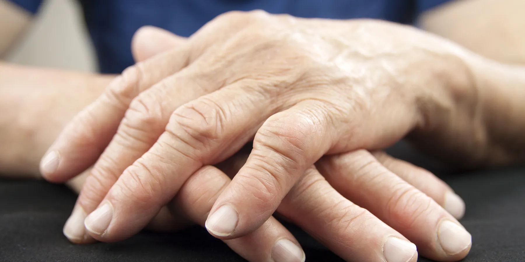 rheumatoid arthritis