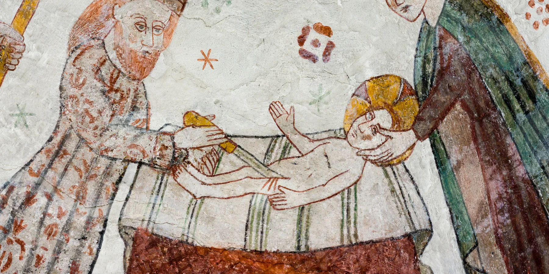 circumcision
