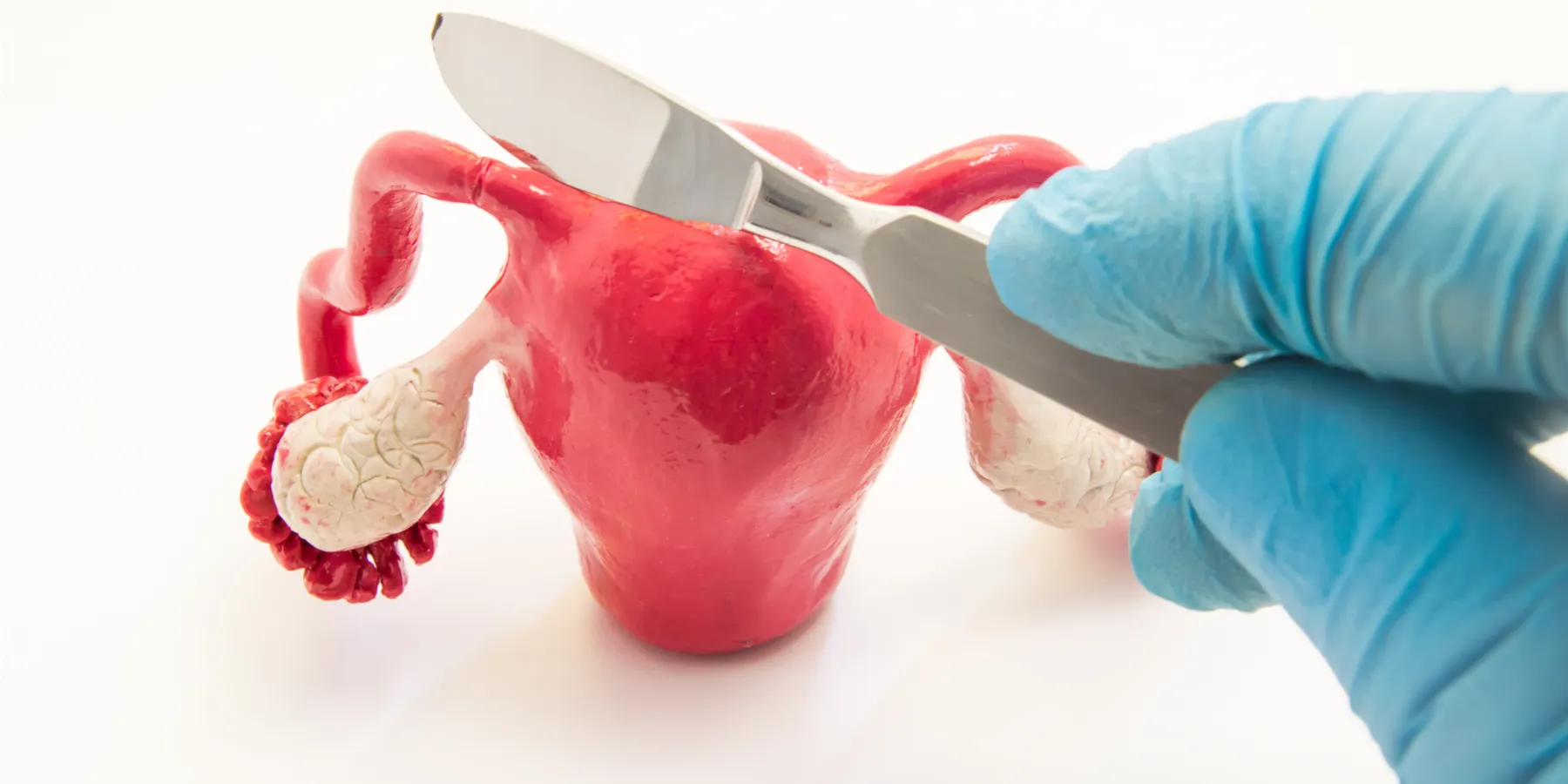 salpingectomy