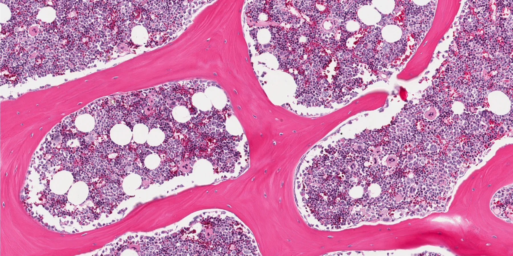 bone marrow