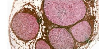 pathology