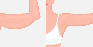 plastic surgery