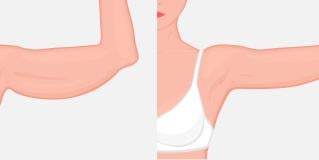 plastic surgery