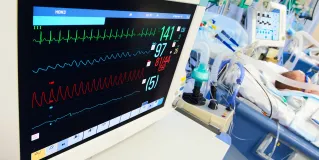 NICU