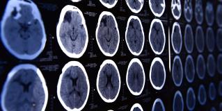 neuroimaging