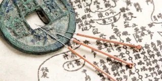 accupuncture
