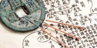 accupuncture