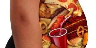 obesity