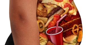 obesity
