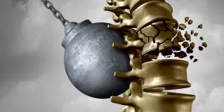 low back pain