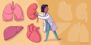manage organ donation