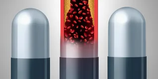 statin use