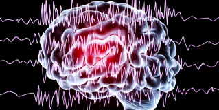 neuromodulation