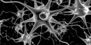 Parkinson's Disease