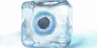 cryopreservation