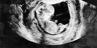ultrasound
