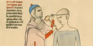 history of neurosurgery