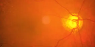 retina