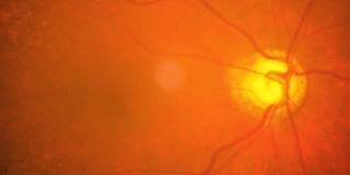 retina
