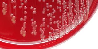 staph aureus