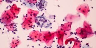 HPV