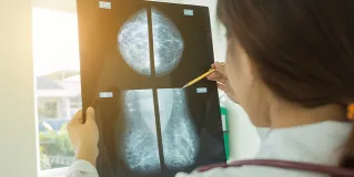breast cancer care
