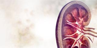 kidney transplantation