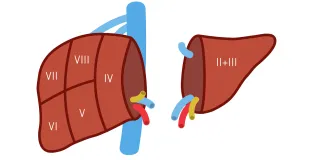 living liver donation