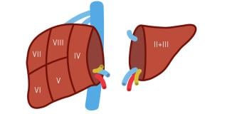living liver donation