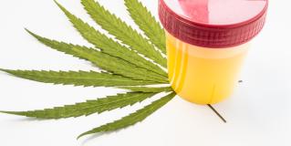 urine drug test