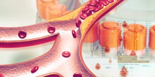 cholesterol testing
