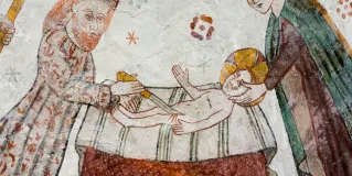 circumcision