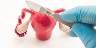 salpingectomy