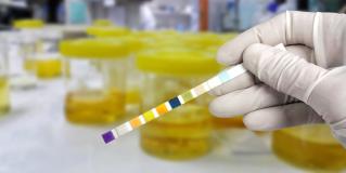 glycosuria 