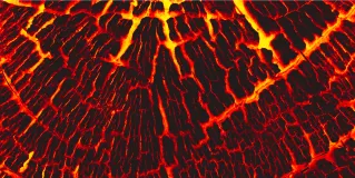 burn patient