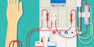 hemodialysis