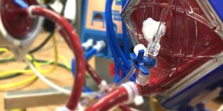 ECMO