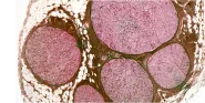 pathology