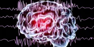 neuromodulation