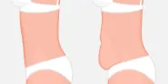 mommy makeover