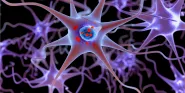 Parkinson's Disease