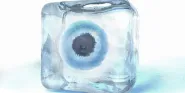 cryopreservation