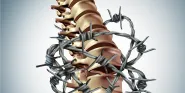 chronic back pain