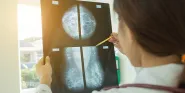 breast cancer care