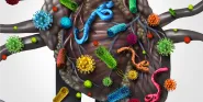 infective endocarditis