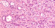 cscm6-2110